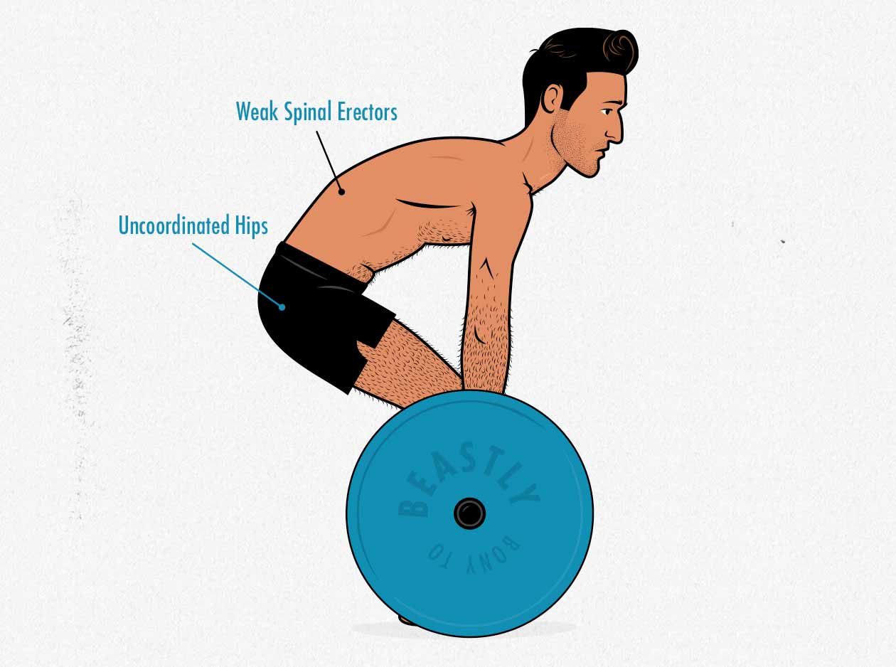 Illustration of an ectomorph rounding his back because his back isn't strong enough yet.