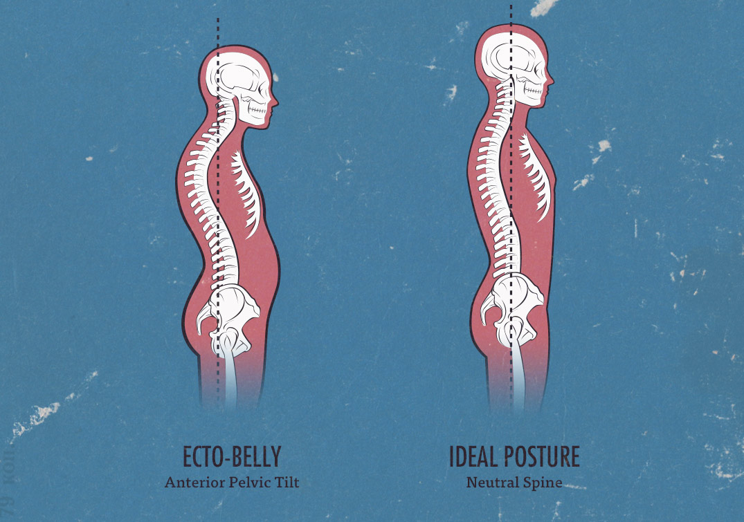 neutral spine, ideal posture, ecto-belly, skinny-fat, and typical ectomorph posture