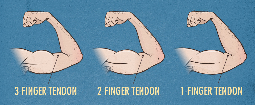 Bony to Beastly Muscle-Building Genetics Small Muscle Bellies