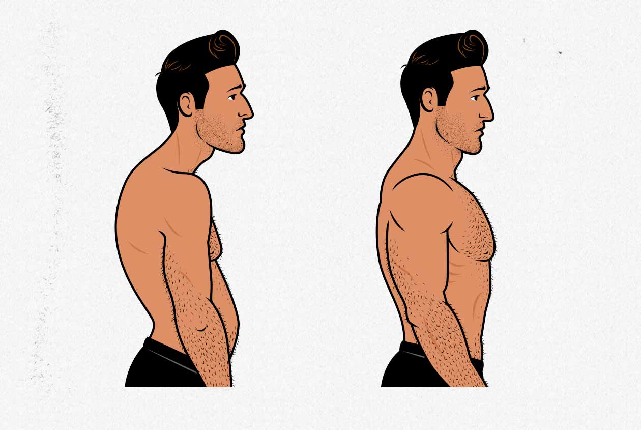 Before/After illustration of a man improving his posture.