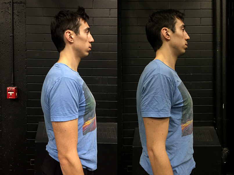 How to thicken my lower torso, especially at the back? My upper back sticks  out quite a bit and my lower torso is very thin, what should I do - Quora