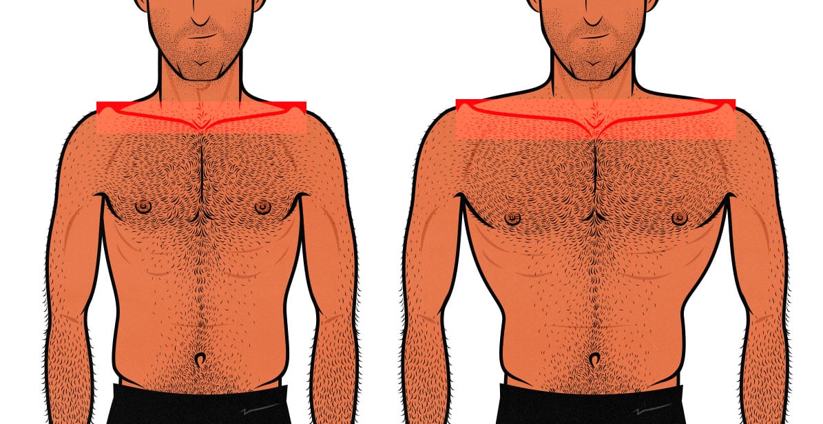 Illustration of a guy with narrow shoulder bone structure vs a guy with naturally broader shoulders.
