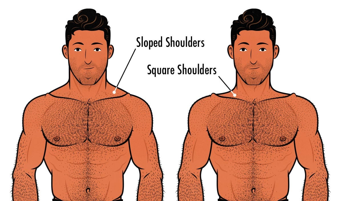 Illustration comparing a man with sloped shoulders (from overdeveloped trap muscles) against a man with square shoulders.