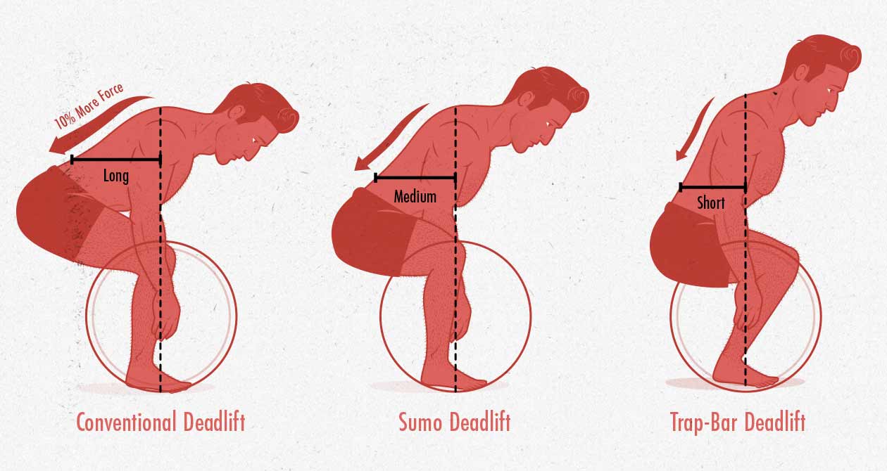 Diagram showing different amounts of lower back stress with conventional, sumo, and trap-bar deadlifts.