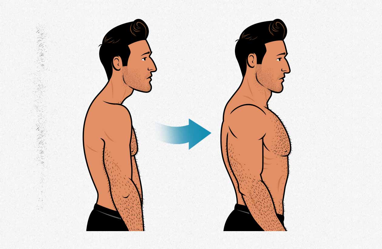 Before and after illustration of a man bulking up his posterior chain (spinal erectors) to improve his aesthetics.