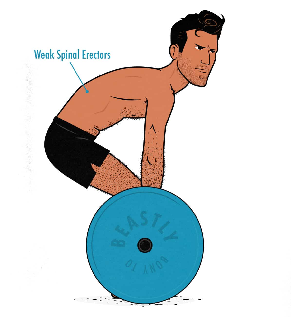 Illustration of a skinny guy deadlifting with a rounded back.