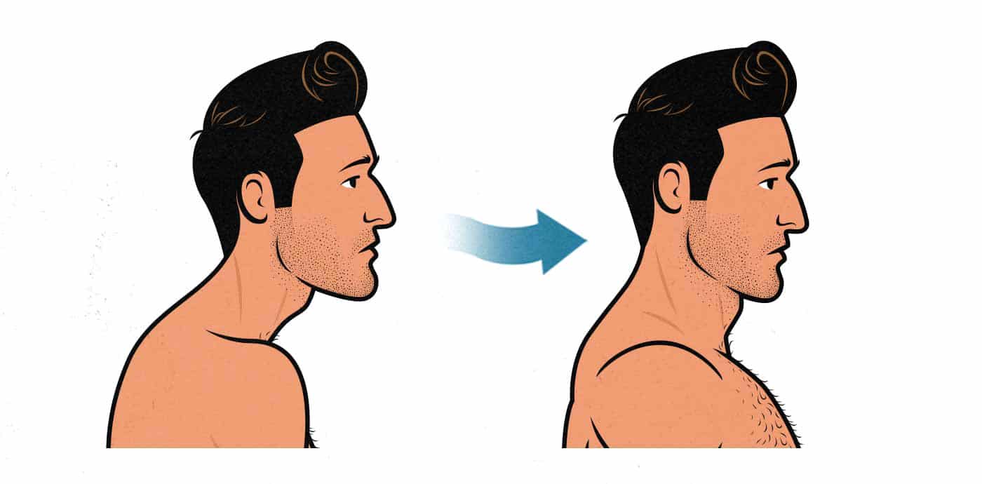 Before and after illustration of a man fixing his forward head posture.