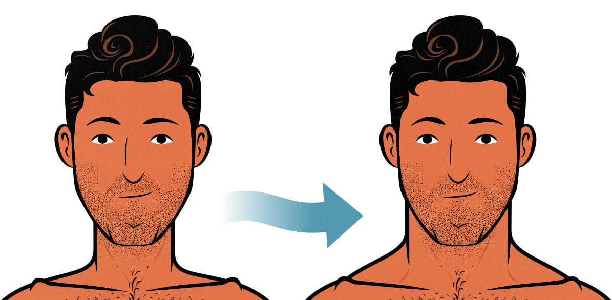 Before and after illustration of a man with a skinny neck building a muscular neck.