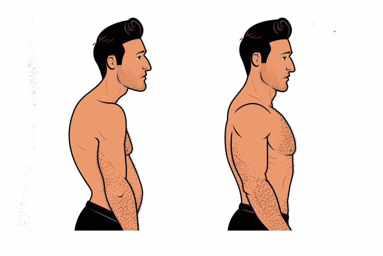 Before/After illustration of a man improving his posture.