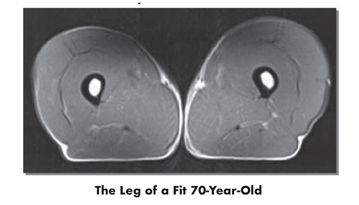 MRI scan showing a lean and muscular 70-year-old.