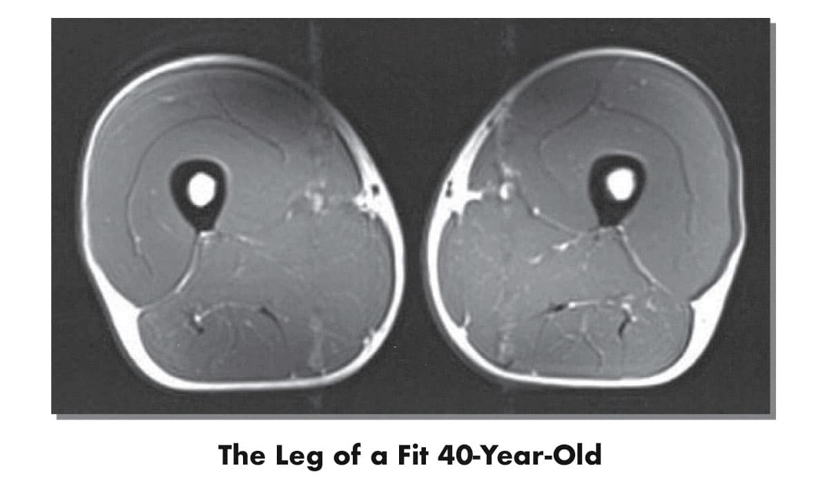 MRI scan showing a muscular 40-year-old.