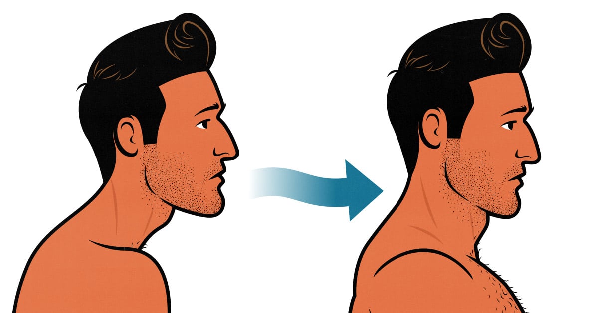 Before and after neck posture transformation.