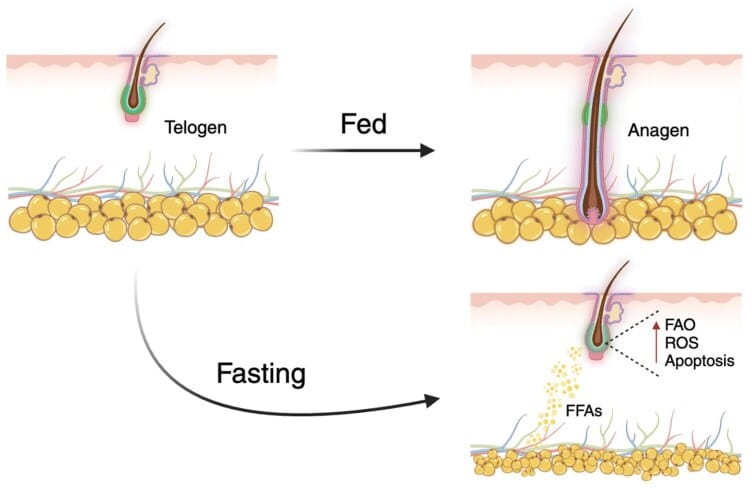 Study diagram showing how intermittent fasting causes hair miniaturization and hair loss.
